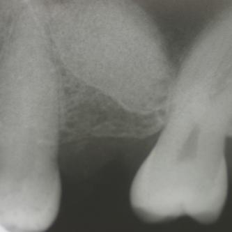 Exemple 14: Radiographie post chirurgicale.